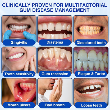 🏅🦷🛡️Evolvion® GumRevive Periodontal Repair Gel