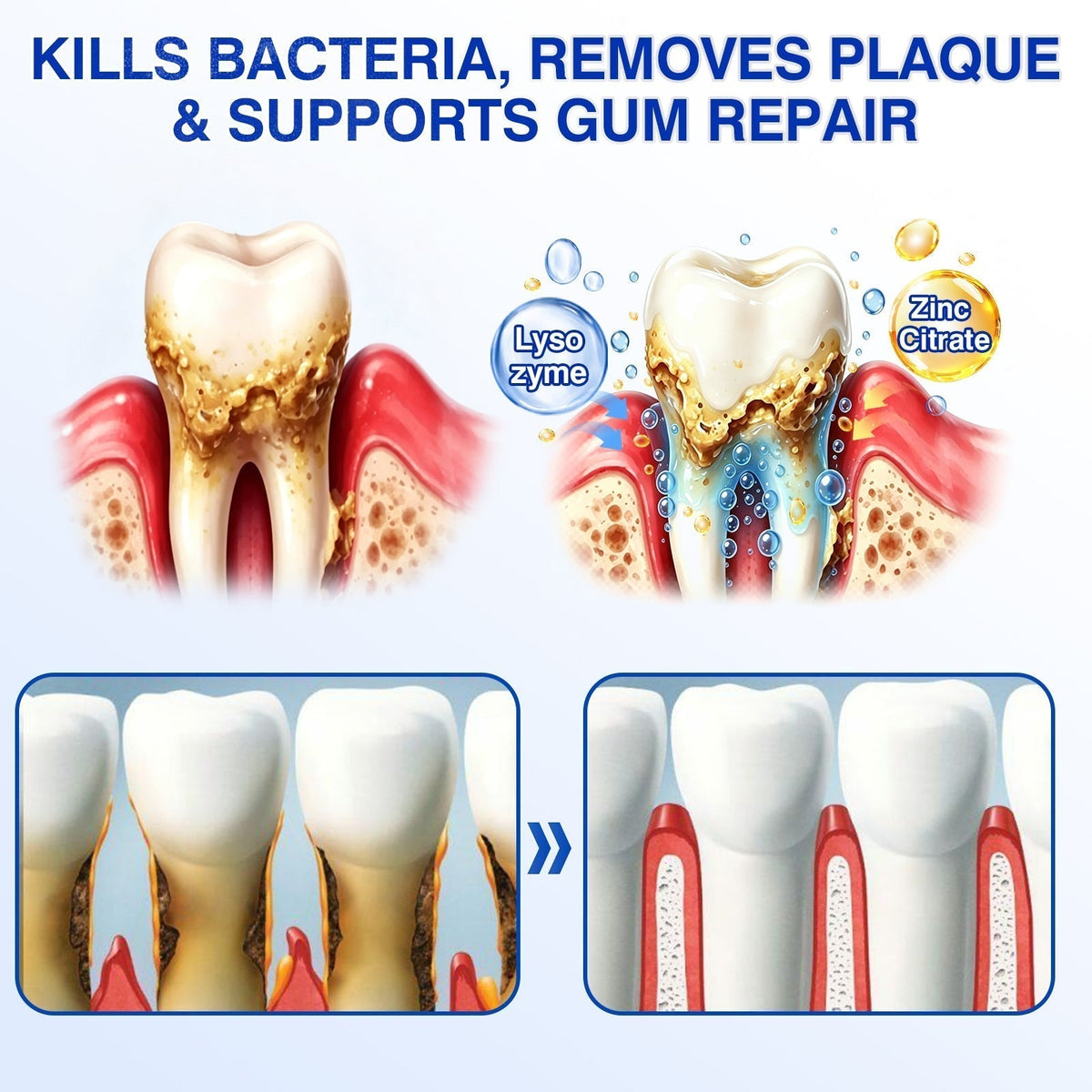 🏅🦷🛡️Evolvion® GumRevive Periodontal Repair Gel