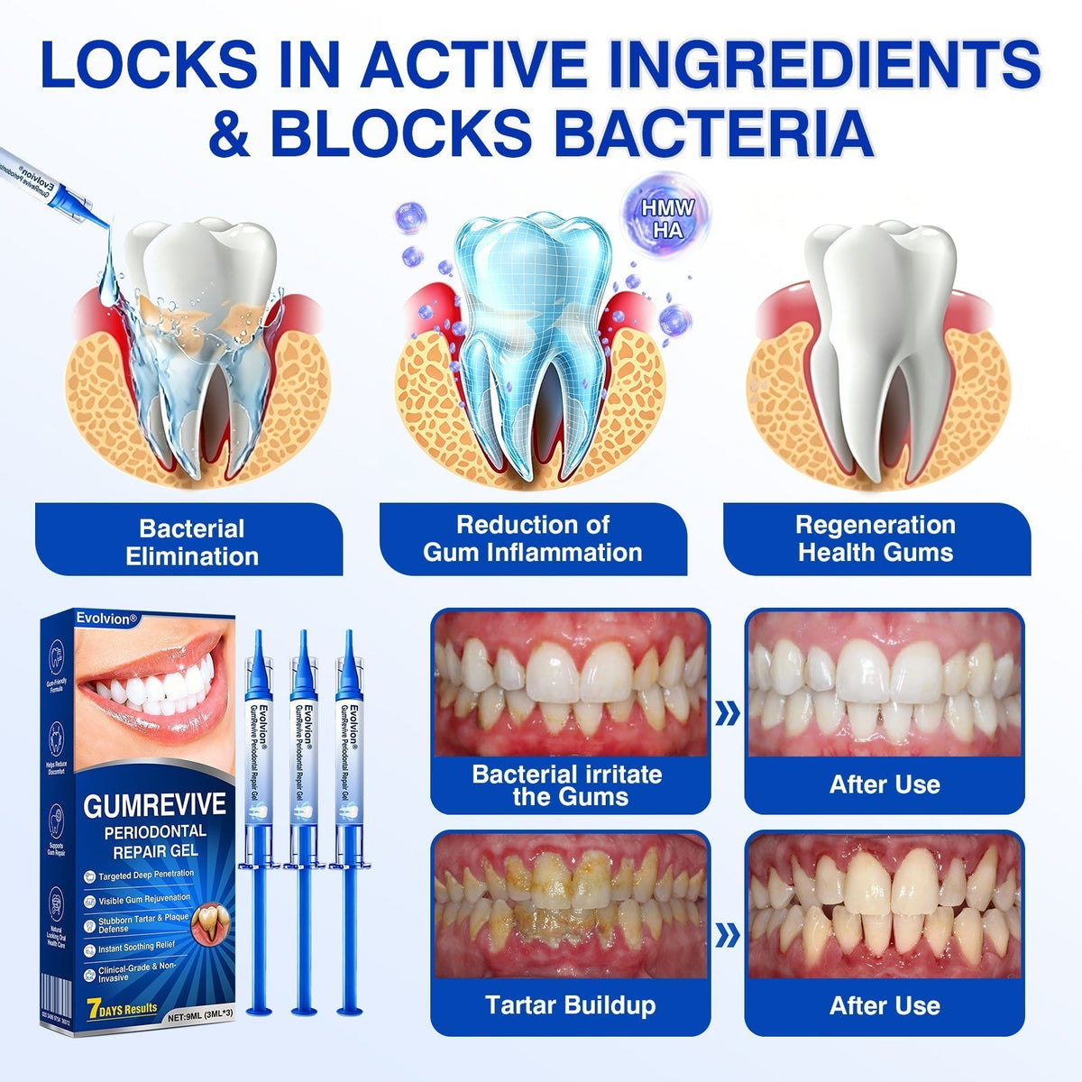 🏅🦷🛡️Evolvion® GumRevive Periodontal Repair Gel
