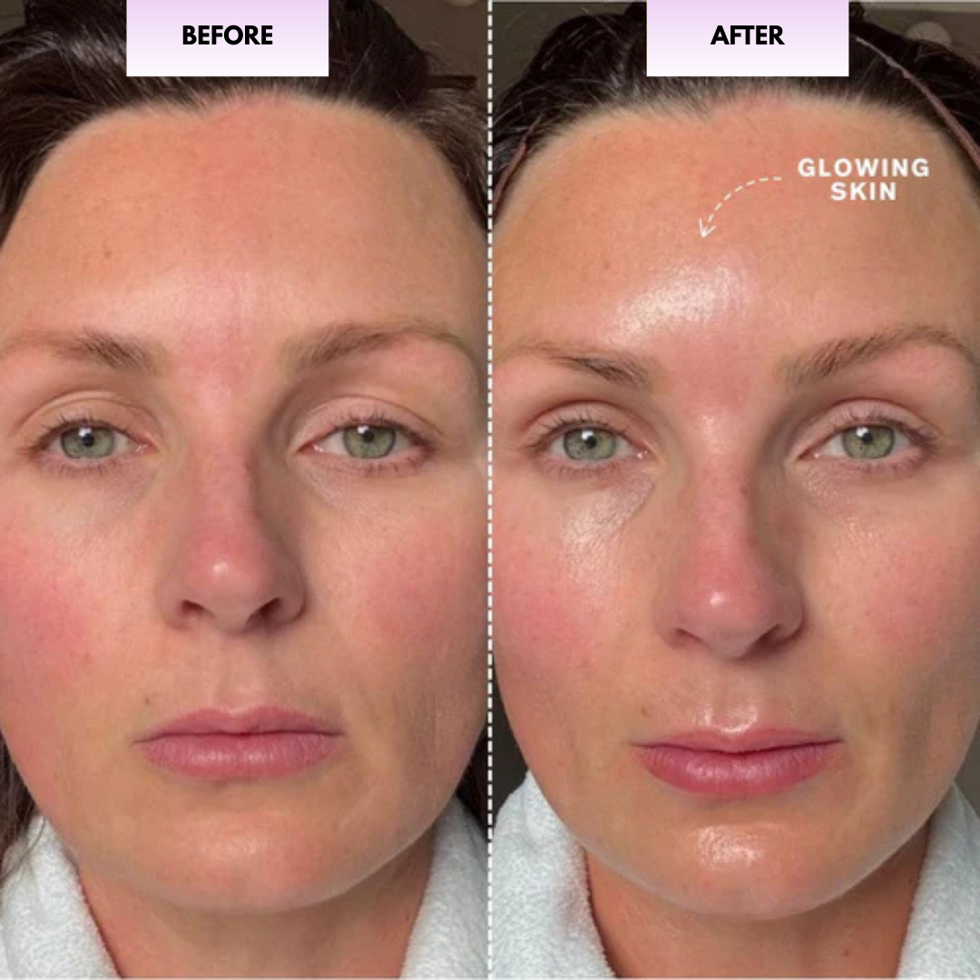 Before and after skin glow